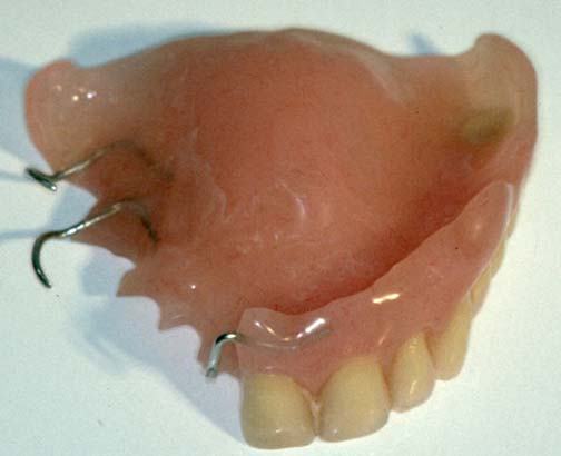 Zahnarzt [  Teilprothesen Soest ] - Praxis Dr. Elke Hubiak